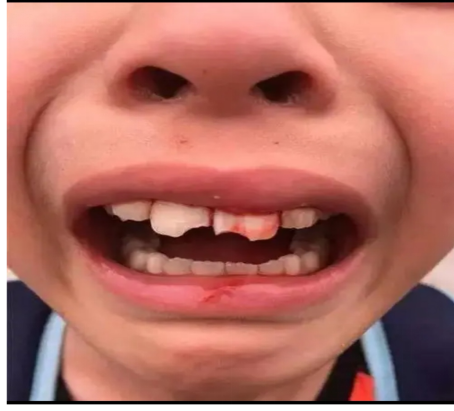 1647225603312710.png image.png